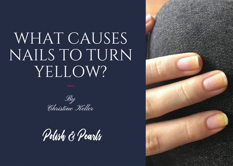 what-causes-nails-to-turn-yellow-polish-and-pearls