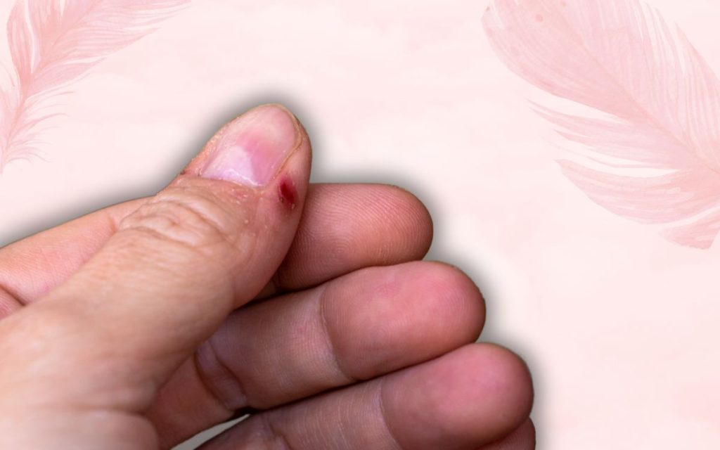 how-to-heal-and-soothe-an-infected-hangnail-polish-and-pearls